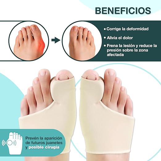 Corrector De Juanetes - Unisex Talla Única (1 par)